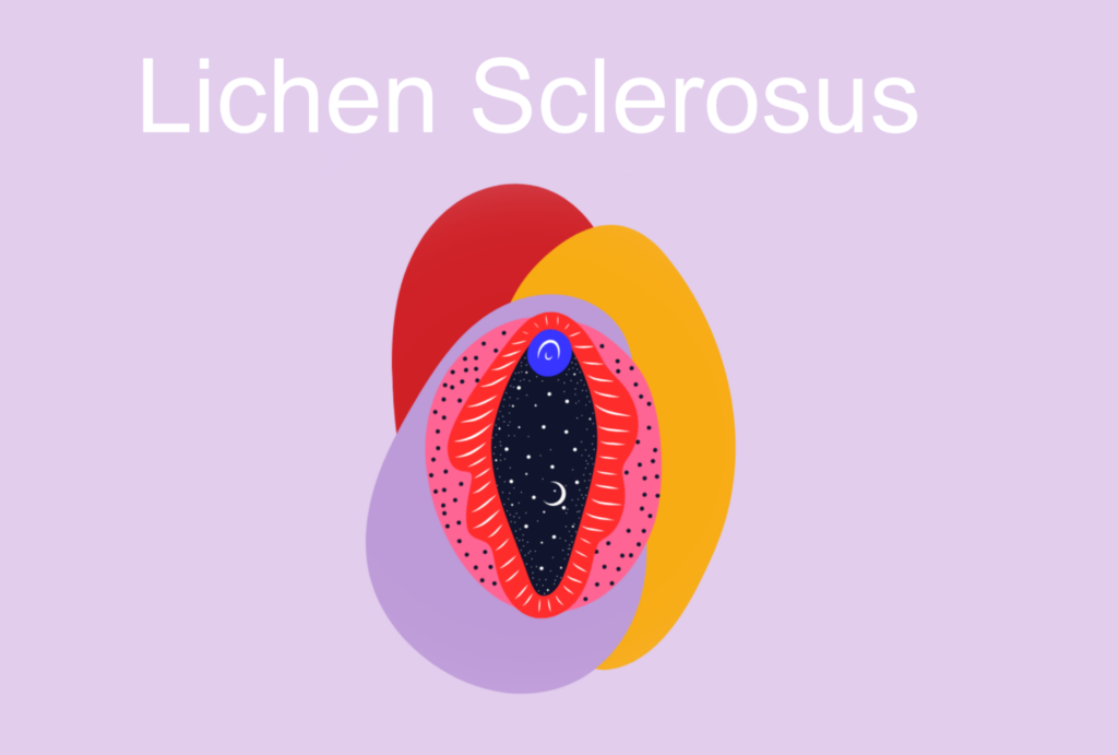 Lichen Sclerosus